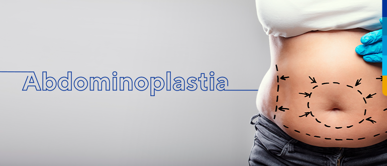 Texto: Abdominoplastia
Ao lado imagem da cintura de uma pessoa com desenhos pontilhados.